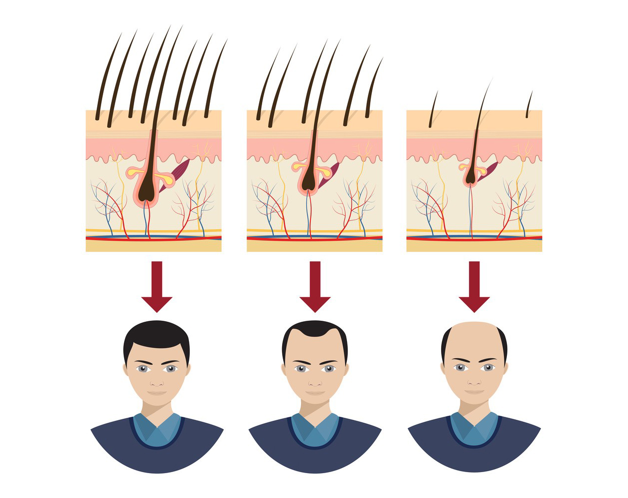 Mechanism of Minoxidil-Xi'an Lyphar Biotech Co., Ltd Mechanism of Minoxidil-Xi'an Lyphar Biotech Co., Ltd
