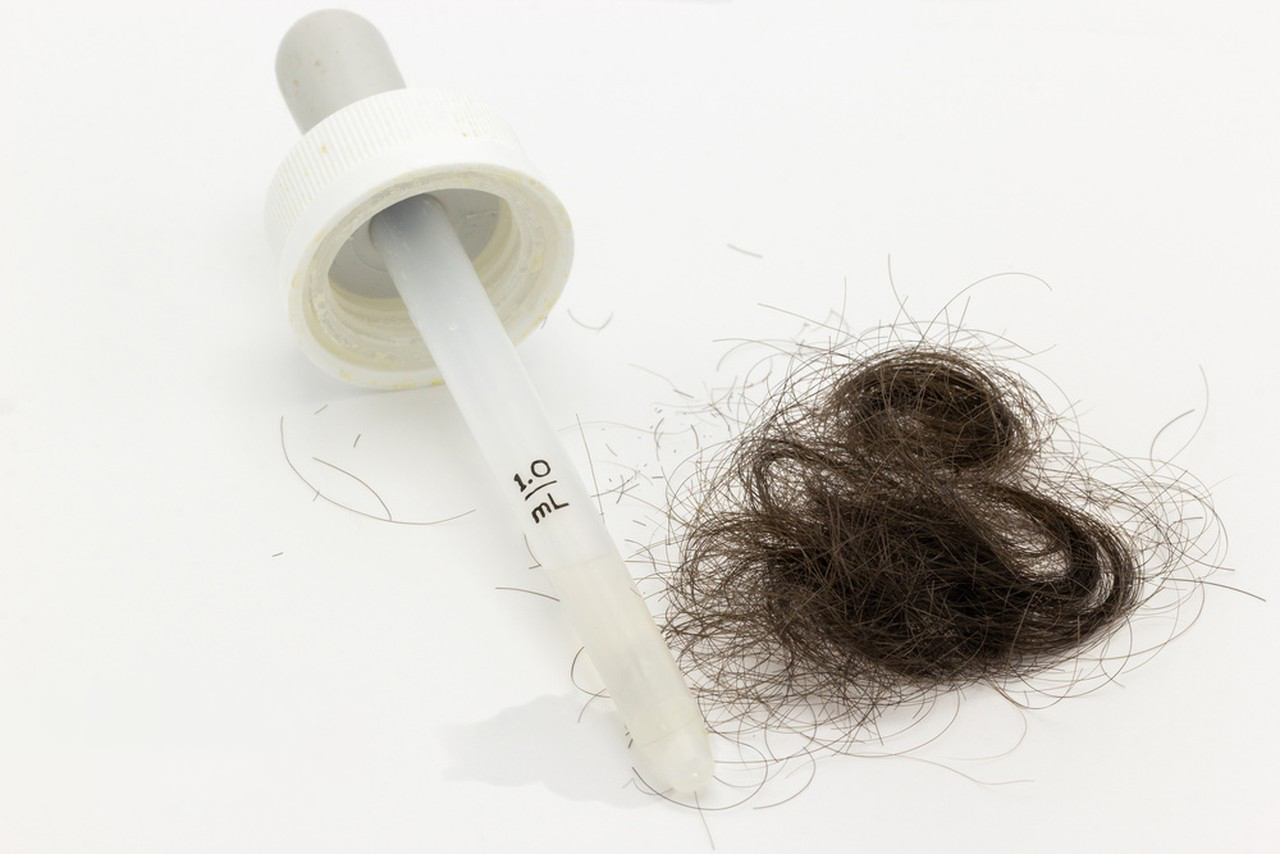 History of Minoxidil-Xi'an Lyphar Biotech Co., Ltd History of Minoxidil-Xi'an Lyphar Biotech Co., Ltd