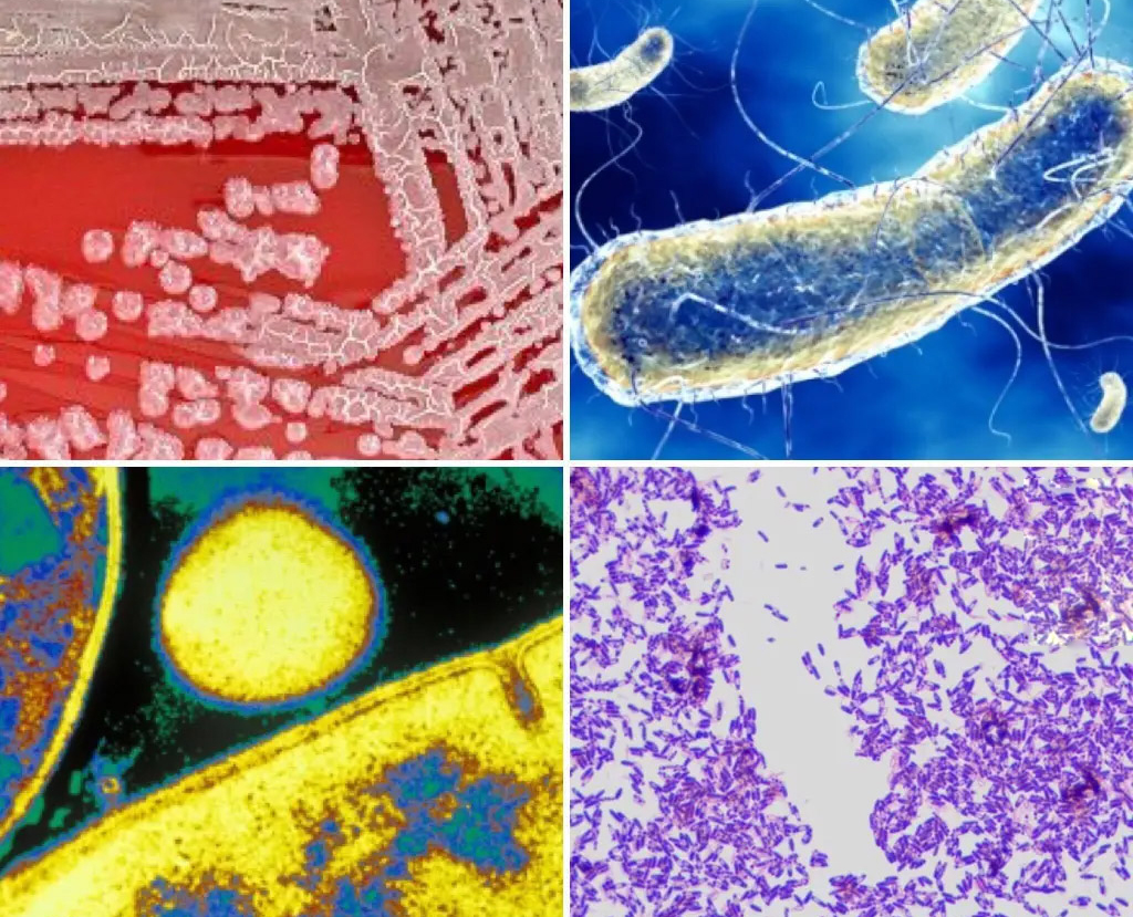 Effects and Function of Bacillus Licheniformis-Xi'an Lyphar Biotech Co., Ltd Effects and Function of Bacillus Licheniformis-Xi'an Lyphar Biotech Co., Ltd
