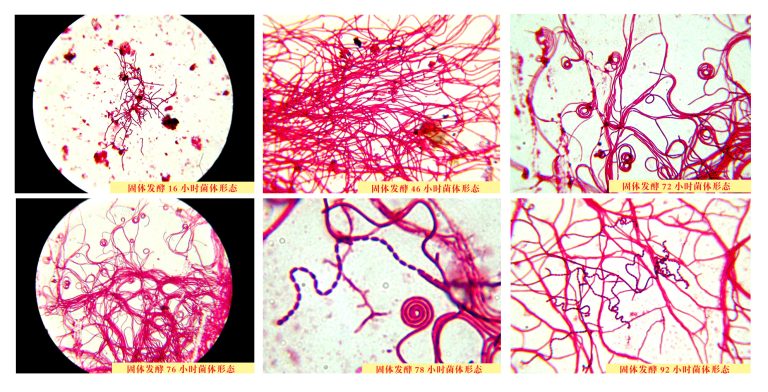 Preparation Method of Bacillus Subtilis 9 2025102908135114