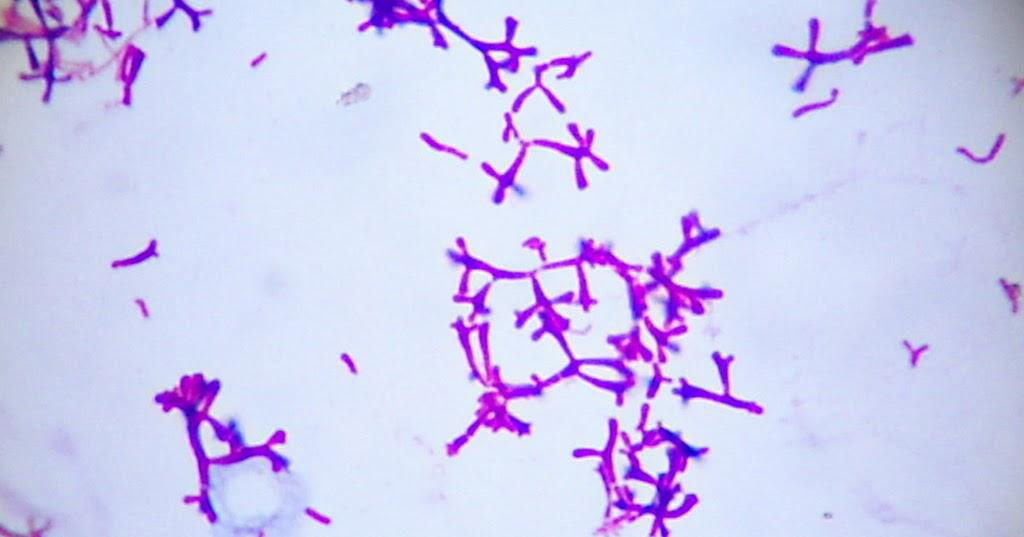 Basic information of Bifida Ferment Lysate-Xi'an Lyphar Biotech Co., Ltd Basic information of Bifida Ferment Lysate-Xi'an Lyphar Biotech Co., Ltd