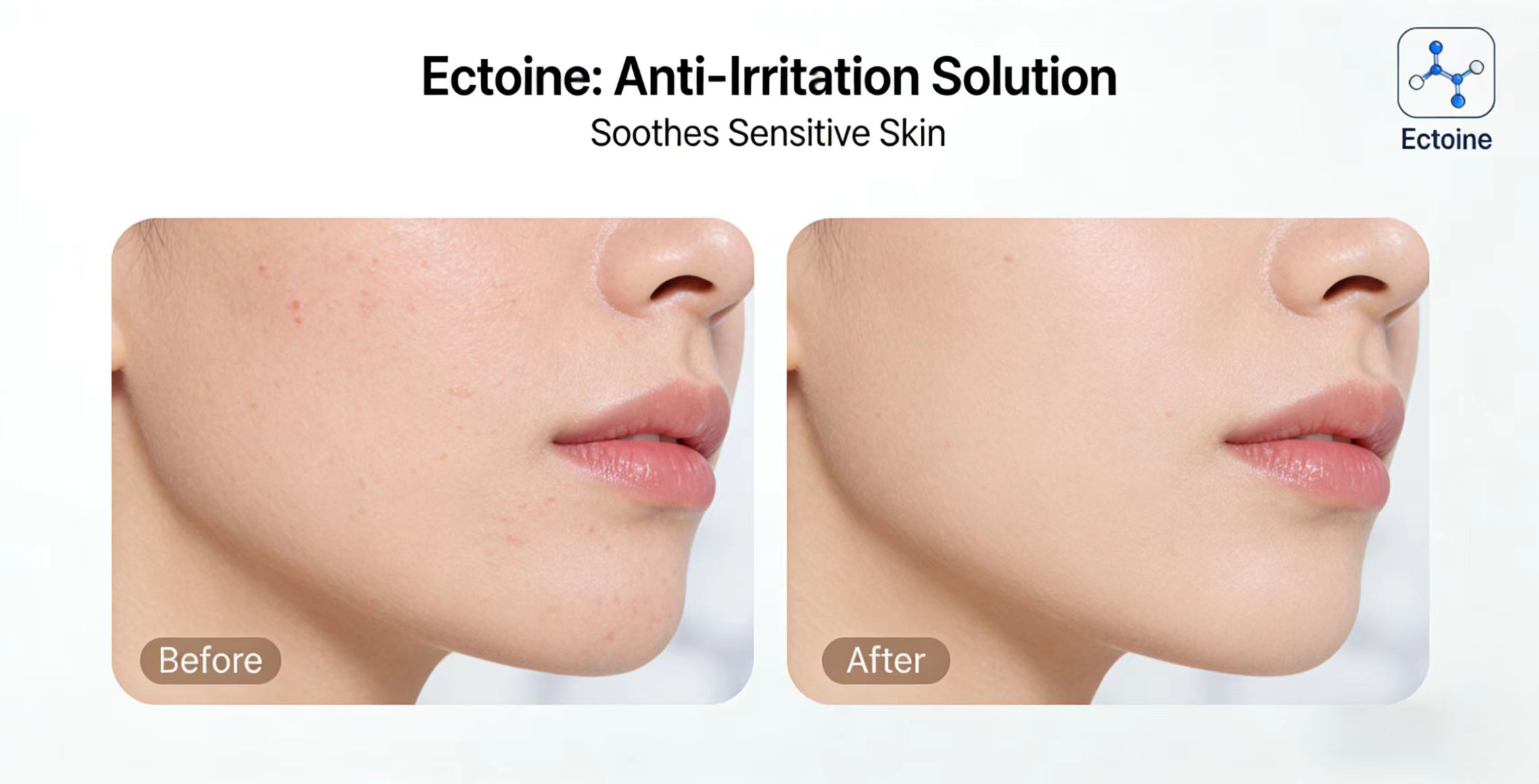 How to use Ectoine for best results?-Xi'an Lyphar Biotech Co., Ltd How to use Ectoine for best results?-Xi'an Lyphar Biotech Co., Ltd